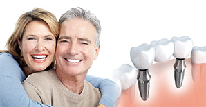 Často kladené otázky o zubných implantátoch